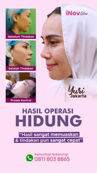 Operasi Hidung Untuk Ujung Hidung Bulat, Ciptakan Hasil Lebih Proporsional di Inov Glow Plastic Surgery