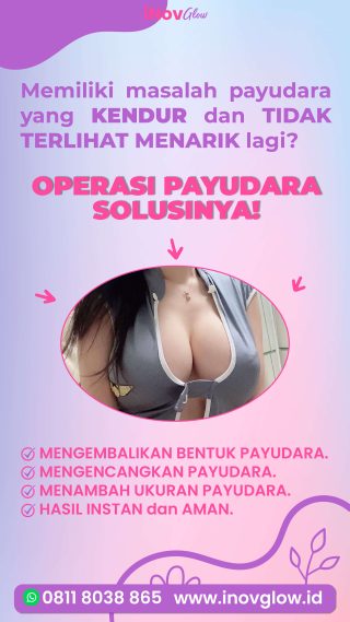 Di Atas vs Di Bawah Otot: Mana Posisi Implan Payudara Terbaik Untuk Anda? Klik Faktanya!