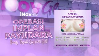 Mencari Bentuk Payudara Baru? Pilihan Pasca Pelepasan Implan Payudara yang Perlu Anda Ketahui