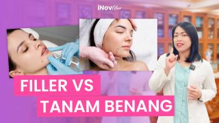 Pilih Mana? Pertimbangan Penting Antara Dermal Filler dan Transfer Lemak Wajah