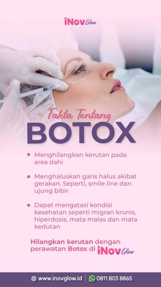Bye Keringat Berlebih! Mengupas Tuntas Manfaat Botox untuk Hiperhidrosis