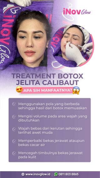 Bye Keringat Berlebih! Mengupas Tuntas Manfaat Botox untuk Hiperhidrosis