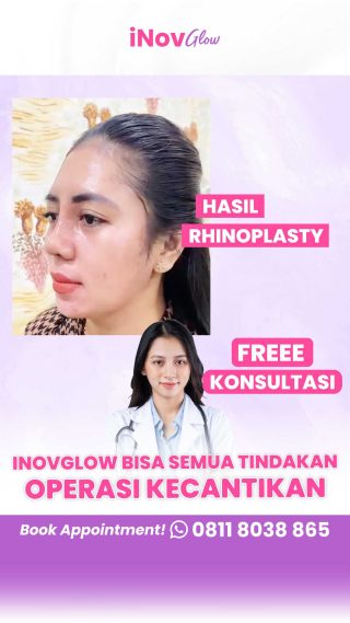 Ingin Operasi Hidung Minimal Invasif? Pahami Rhinoplasty Tertutup dan Manfaatnya di Sini!