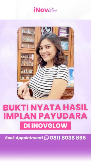 Kelebihan dan Kekurangan Pembesaran Payudara dengan Cangkok Lemak: Apa Saja yang Perlu Anda Tahu?