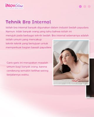 Apa Itu Bra Internal? Solusi Payudara Kencang Lebih Lama, Cek Kelebihannya!