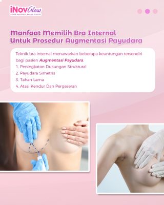 Apa Itu Bra Internal? Solusi Payudara Kencang Lebih Lama, Cek Kelebihannya!